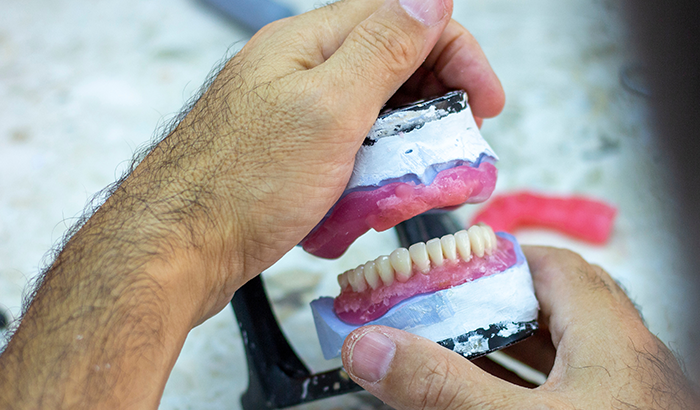 Everything You Need to Know About Full Mouth Reconstruction