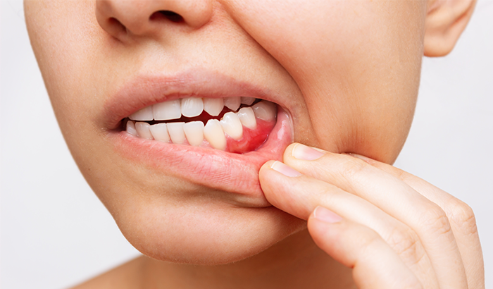 History of Gum Disease or Failing Teeth You need a Periodontal Prosthodontist